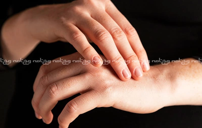 درمان‌های سنتی برای نیش زنبور عسل