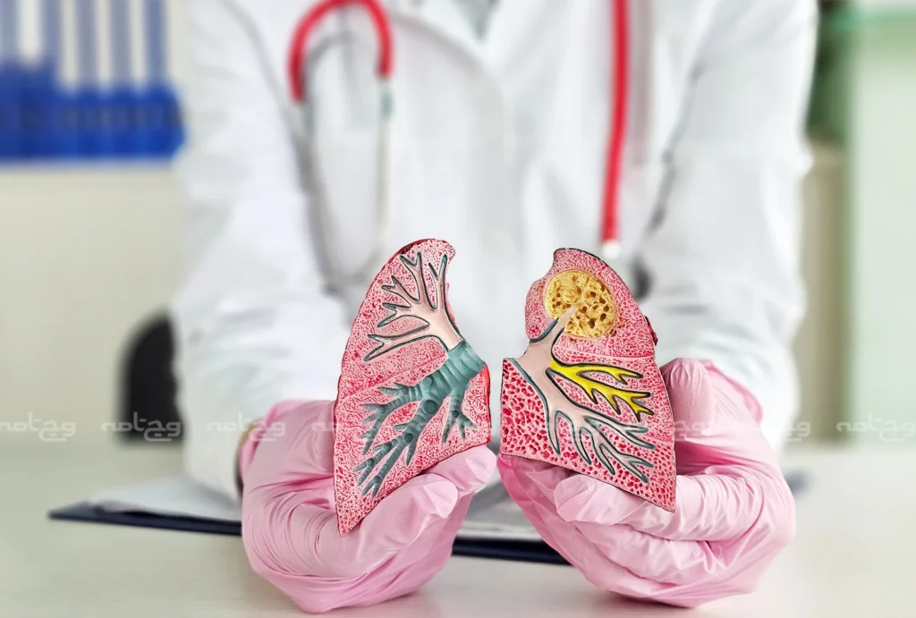 بیماری‌های تنفسی؛ پیشگیری، علائم و درمان بیماری‌های ریوی